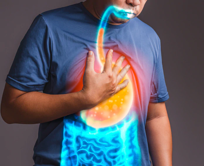 acid