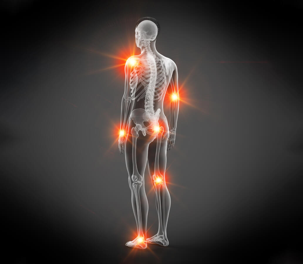 Body inflamations